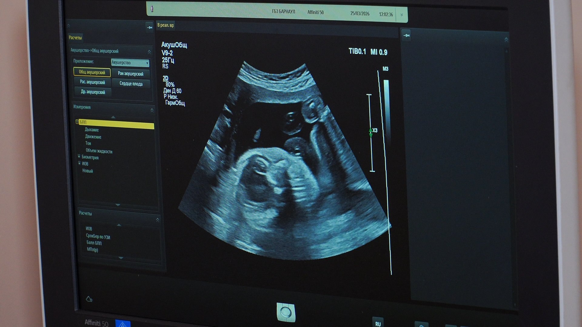 Врачи барнаульской больницы № 3 бесплатно учат будущих мам правильному дыханию и уходу за младенцами Врачи барнаульской больницы № 3 бесплатно учат будущих мам правильному дыханию и уходу за младенцами