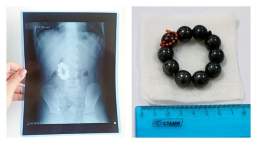 � �������� ����� ������ ������������� ��������, ������� ��������� ������ ��������� ������� � ������������� �������