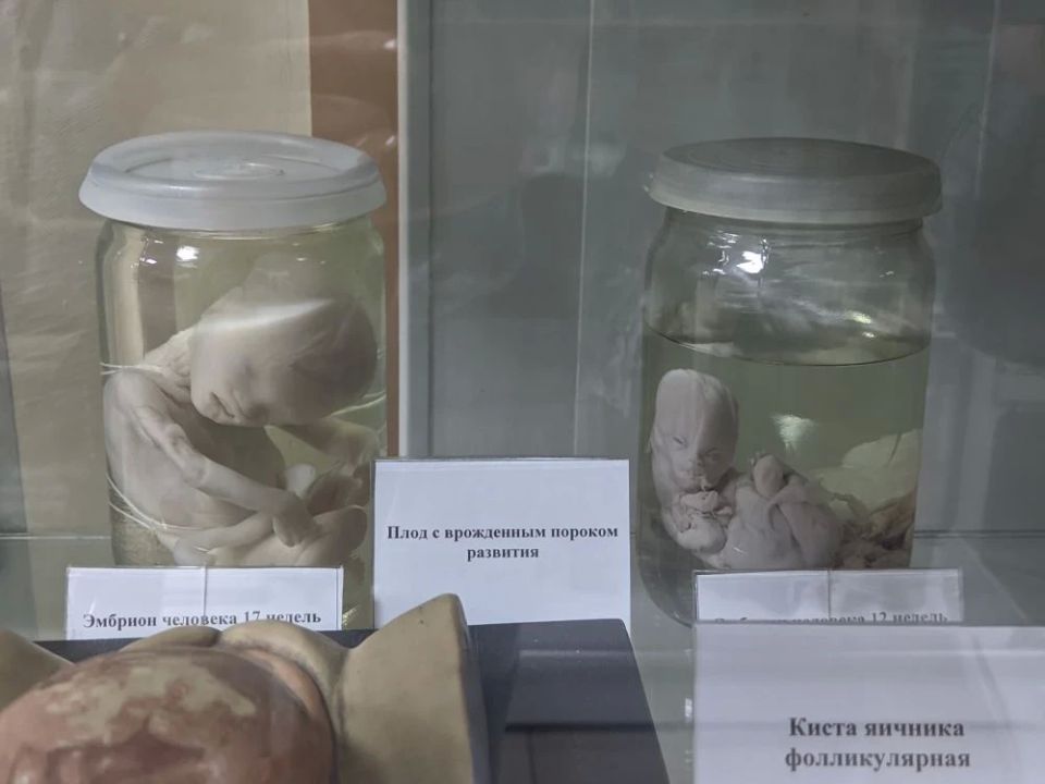 В музее Медицинского университета можно от сглаза полечиться и на эмбрионов посмотреть В музее Медицинского университета можно от сглаза полечиться и на эмбрионов посмотреть