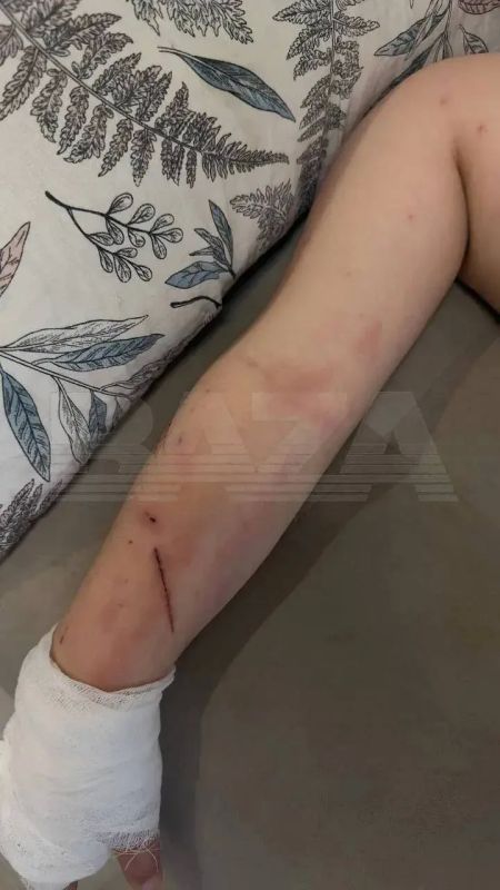 Пятилетняя девочка попала в больницу после поглаживаний кота в Барнауле