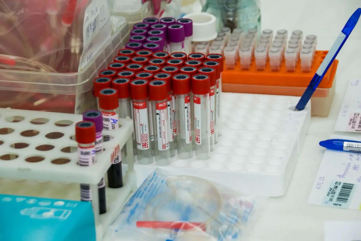 Жители Барнаула смогут бесплатно и анонимно сдать тест на ВИЧ
