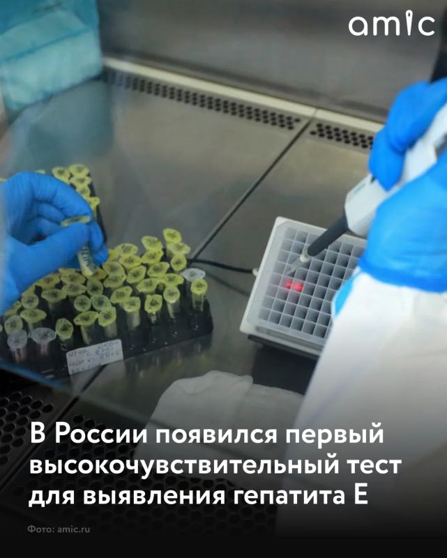 В России зарегистрирован первый отечественный тест с высокой чувствительностью для диагностики гепатита E, сообщили в пресс-службе Роспотребнадзора РИА Новости